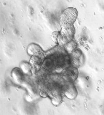 Intestinal organoid derived from a small intestinal crypt from a C57BL/6J mouse, embedded in a 3D collagenous matrix; photografer: Florian Tran, IKMB