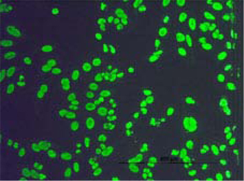 help cells showing presence of ANA, photo: ins